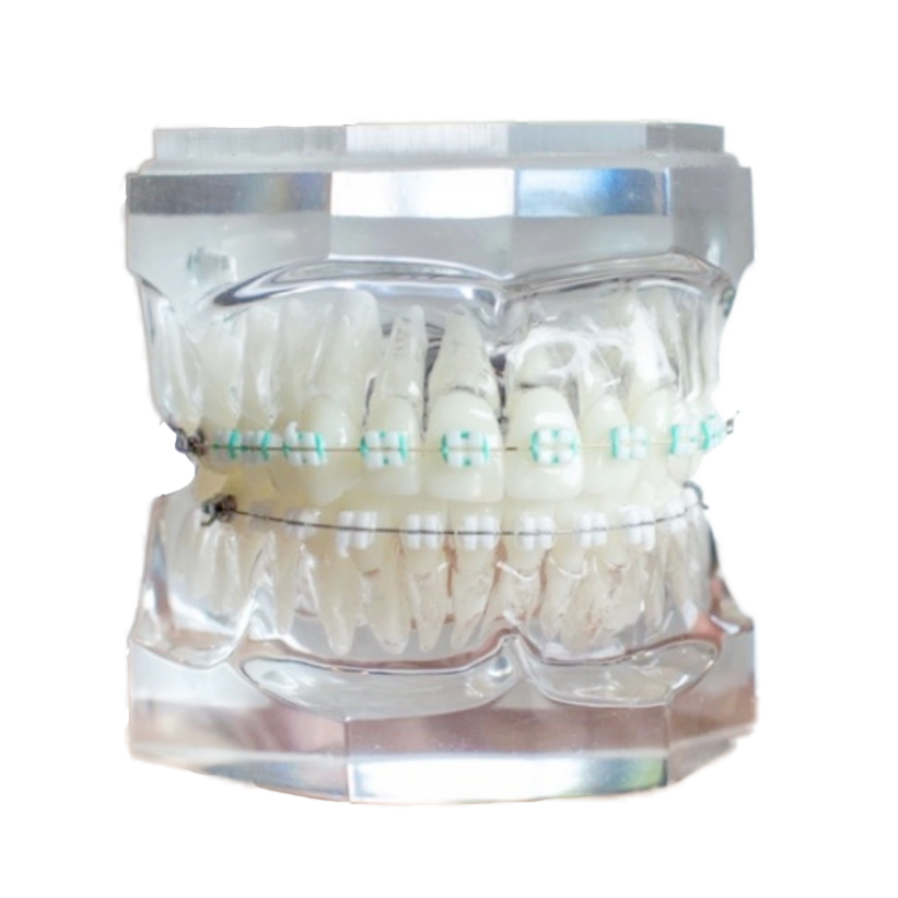 Invisalign braces - Colton Modern Dentistry