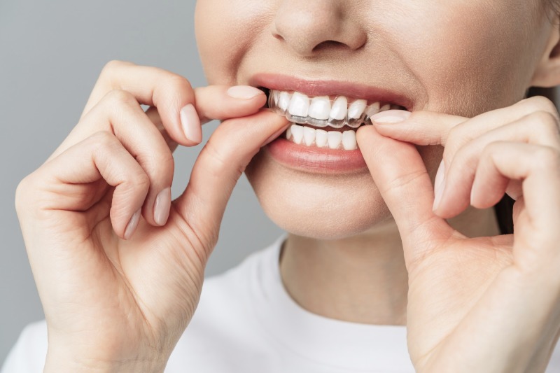 Orthodontics In Connecticut - Feldman Orthodontics